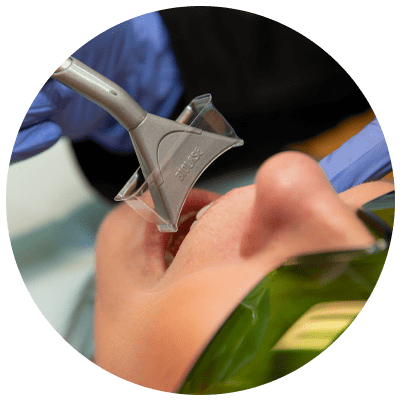 dental patient undergoing laser procedure